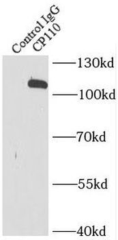 CCP110 Antibody