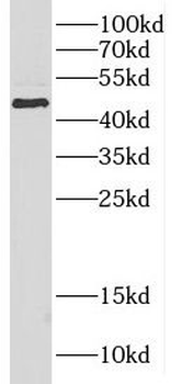 CPB1 Antibody