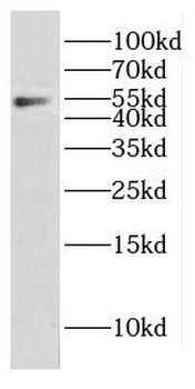 CPEB1 Antibody