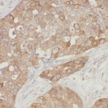 CPEB1 Antibody