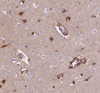 CPLX1 Antibody