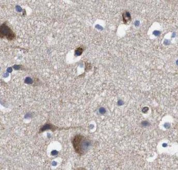 CPLX2 Antibody