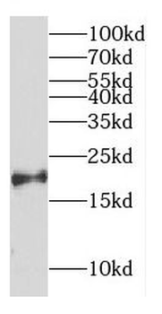 CPLX2 Antibody