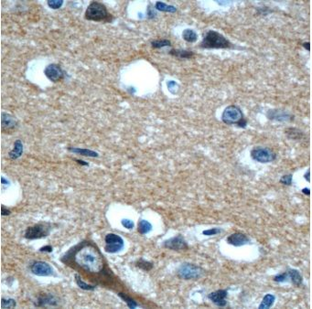 CPLX2 Antibody