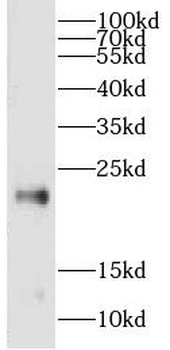 CPLX3 Antibody