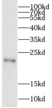 CPLX4 Antibody
