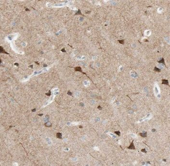 CPLX4 Antibody