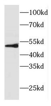 CPN1 Rabbit Polyclonal Antibody