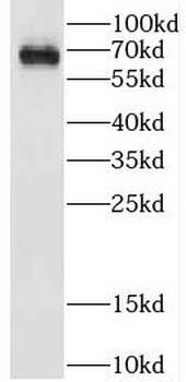 CPNE5 Rabbit Polyclonal Antibody