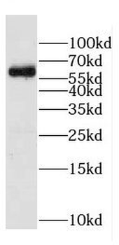 CPNE6 Antibody
