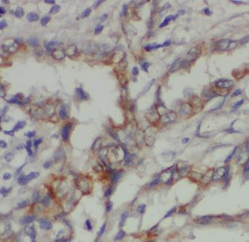 CPNE8 Antibody