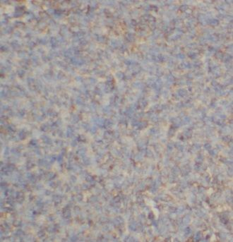 CPPED1 Antibody