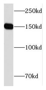 CPS1 Antibody