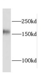 CPSF1 Rabbit Polyclonal Antibody