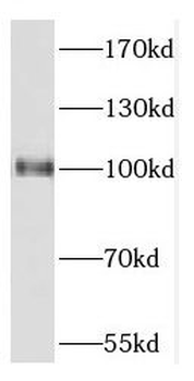 CPSF2 Antibody