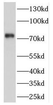 CPSF3 Rabbit Polyclonal Antibody