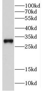 CPSF4 Antibody