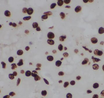 CPSF6 Antibody