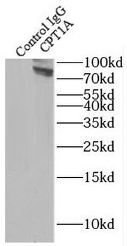 CPT1A Antibody