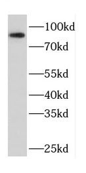 CPT1A Antibody