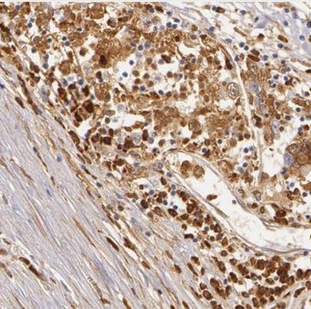 CPT1A Antibody