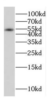 CPVL Antibody