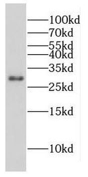 CPXCR1 Antibody