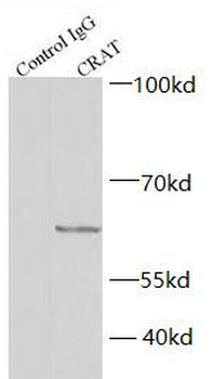 CRAT Antibody