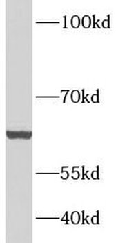 CRAT Antibody