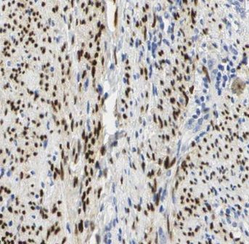 CRBN Antibody