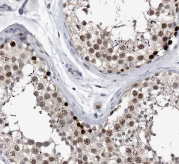 CRCP Antibody
