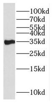 CRH Rabbit Polyclonal Antibody
