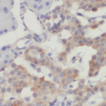 CRH Rabbit Polyclonal Antibody