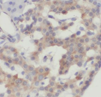 CRISP3 Antibody