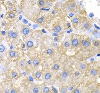 CRK Rabbit Polyclonal Antibody