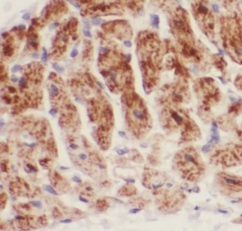 CRLS1 Antibody