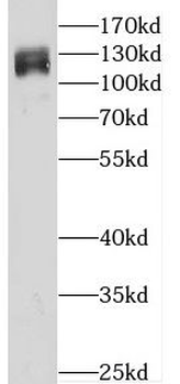 XPO1 Rabbit Polyclonal Antibody