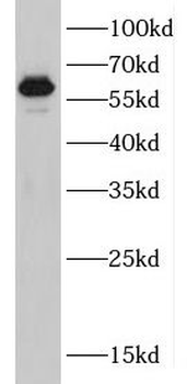 DPYSL2 Rabbit Polyclonal Antibody