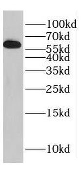 DPYSL5 Antibody