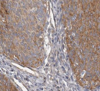 CRNN Antibody