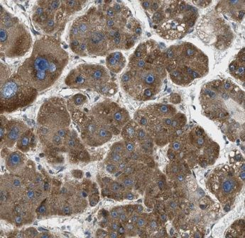 CROT Antibody