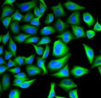 CRP Rabbit Polyclonal Antibody