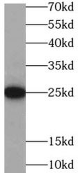 CRP Rabbit Polyclonal Antibody