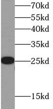 CRP Mouse Monoclonal Antibody