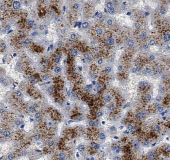 CRP Mouse Monoclonal Antibody
