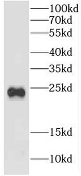 CRYBB2 Antibody