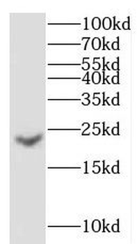 CRYGC Rabbit Polyclonal Antibody