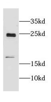 CRYGN Antibody