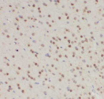CRY1 Antibody