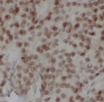 CSE1L Antibody